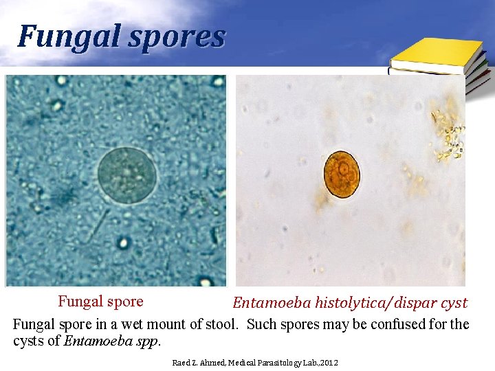 Fungal spores Fungal spore Entamoeba histolytica/dispar cyst Fungal spore in a wet mount of