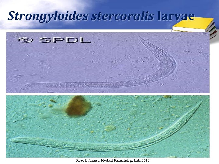 Strongyloides stercoralis larvae Raed Z. Ahmed, Medical Parasitology Lab. , 2012 