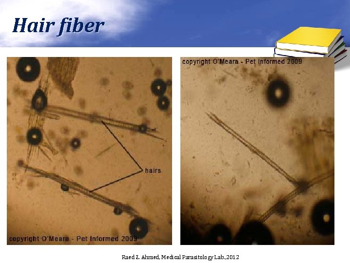 Hair fiber Raed Z. Ahmed, Medical Parasitology Lab. , 2012 