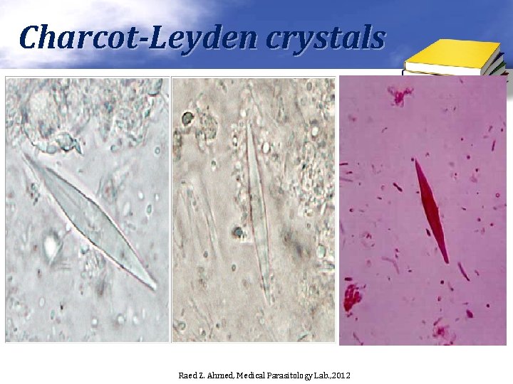 Charcot-Leyden crystals Raed Z. Ahmed, Medical Parasitology Lab. , 2012 