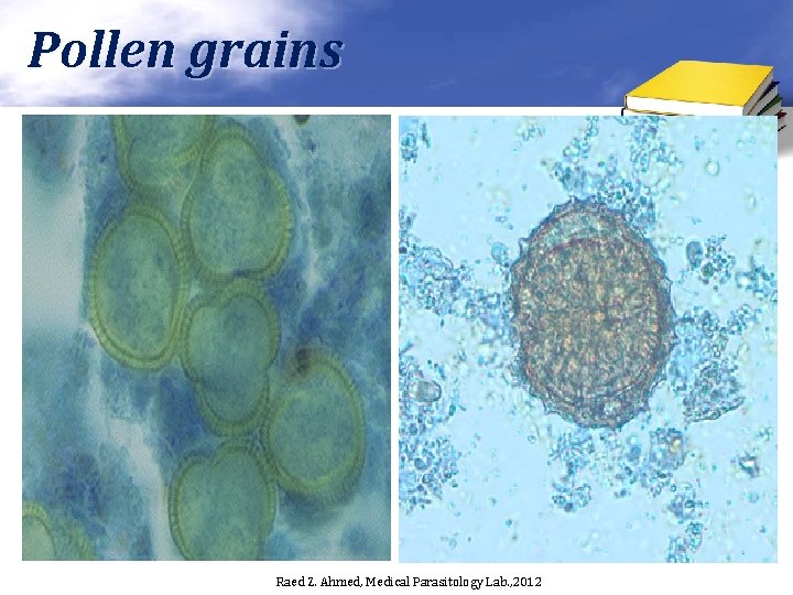 Pollen grains Raed Z. Ahmed, Medical Parasitology Lab. , 2012 