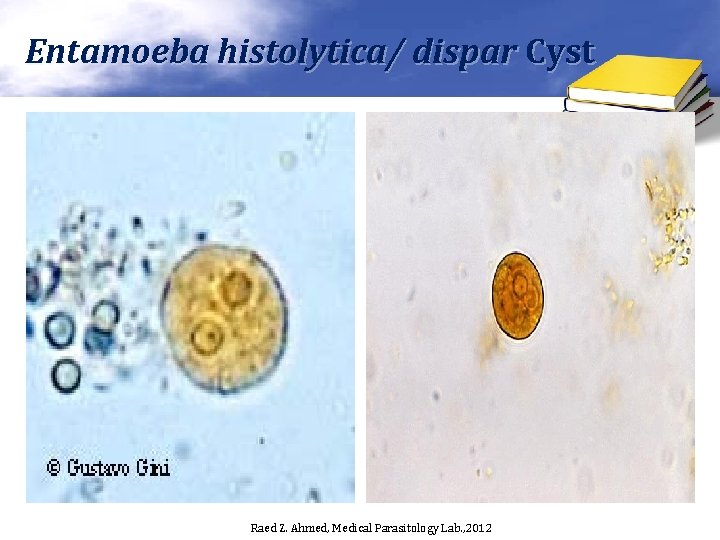 Entamoeba histolytica/ dispar Cyst Raed Z. Ahmed, Medical Parasitology Lab. , 2012 