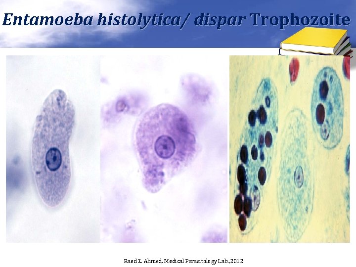 Entamoeba histolytica/ dispar Trophozoite Raed Z. Ahmed, Medical Parasitology Lab. , 2012 