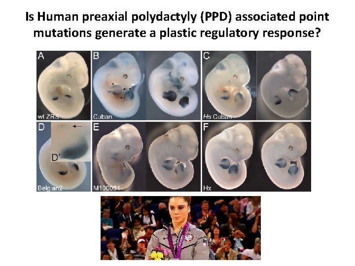 Is Human preaxial polydactyly (PPD) associated point mutations generate a plastic regulatory response? 