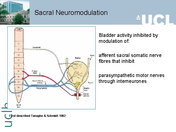 Sacral Neuromodulation Bladder activity inhibited by modulation of: afferent sacral somatic nerve fibres that