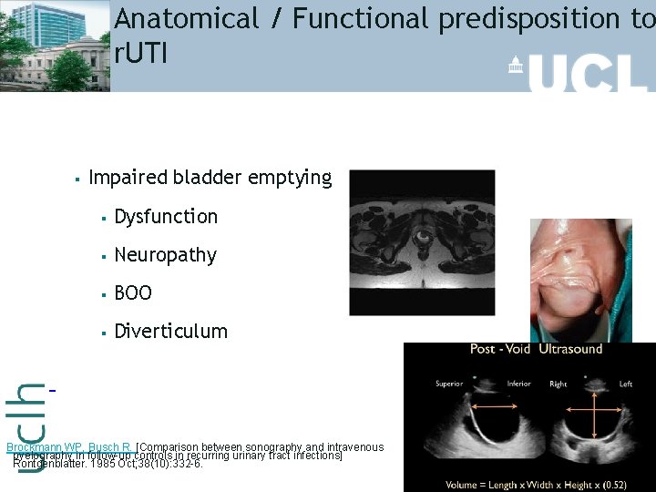 Anatomical / Functional predisposition to r. UTI § Impaired bladder emptying § Dysfunction §