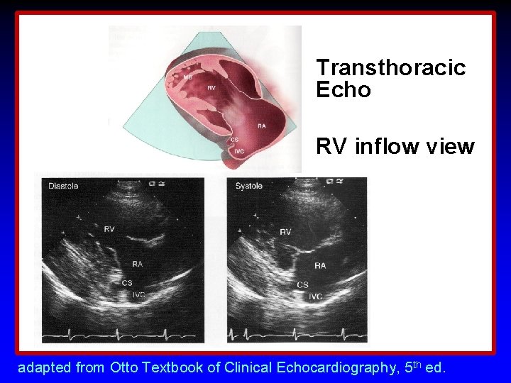 Transthoracic Echo RV inflow view adapted from Otto Textbook of Clinical Echocardiography, 5 th Transthoracic Echo RV inflow view adapted from Otto Textbook of Clinical Echocardiography, 5 th