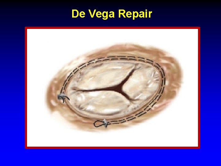 De Vega Repair De Vega Repair