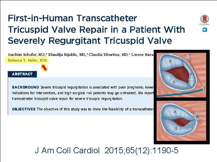 J Am Coll Cardiol 2015; 65(12): 1190 -5 J Am Coll Cardiol 2015; 65(12): 1190 -5