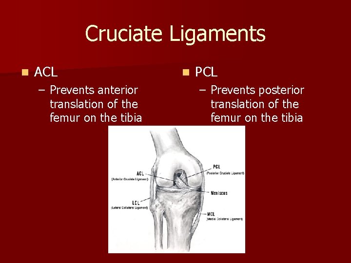 Cruciate Ligaments n ACL – Prevents anterior translation of the femur on the tibia