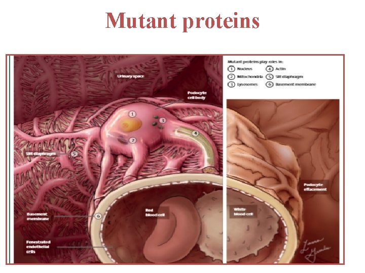 Mutant proteins Mutant proteins