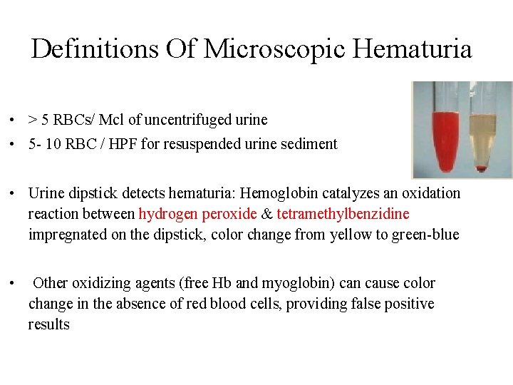Definitions Of Microscopic Hematuria • > 5 RBCs/ Mcl of uncentrifuged urine • 5 Definitions Of Microscopic Hematuria • > 5 RBCs/ Mcl of uncentrifuged urine • 5