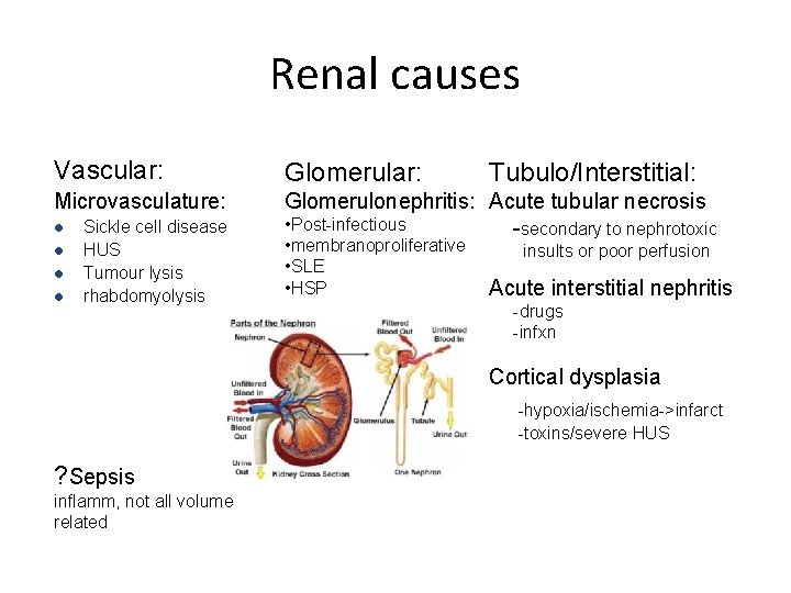 Renal causes Vascular: Glomerular: Microvasculature: Glomerulonephritis: Acute tubular necrosis • Post-infectious -secondary to nephrotoxic Renal causes Vascular: Glomerular: Microvasculature: Glomerulonephritis: Acute tubular necrosis • Post-infectious -secondary to nephrotoxic