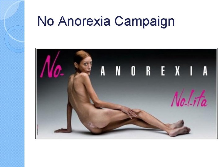 No Anorexia Campaign No Anorexia Campaign