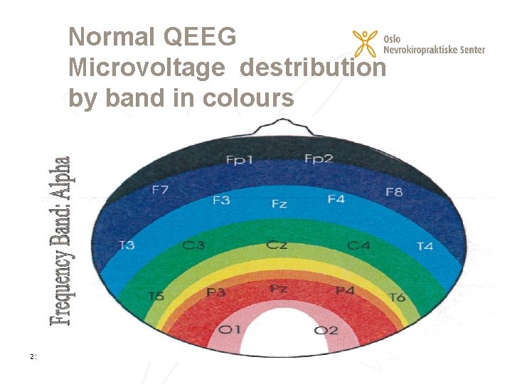 Normal QEEG Microvoltage destribution by band in colours 21. 02. 2021 11 
