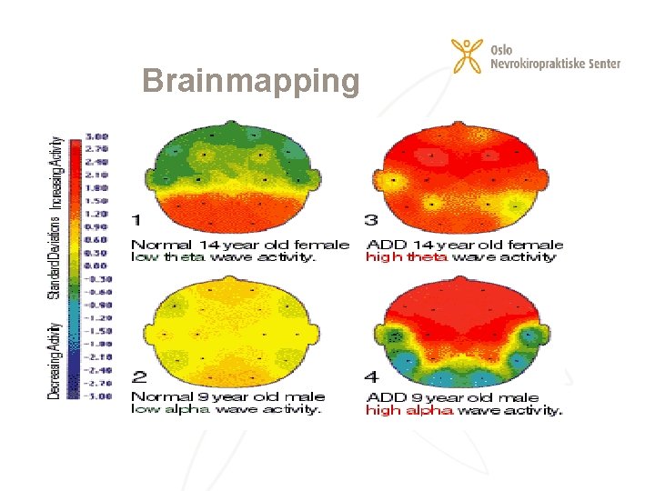 Brainmapping 