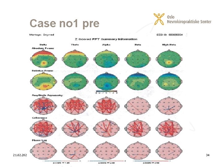 Case no 1 pre 21. 02. 2021 34 