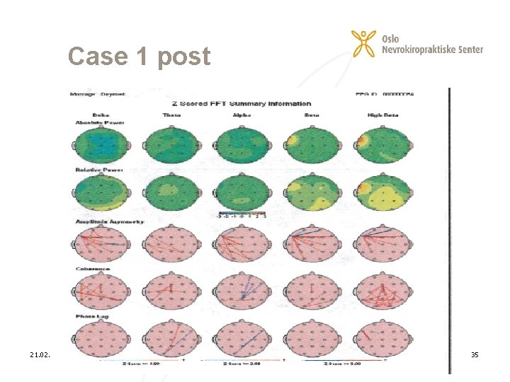 Case 1 post 21. 02. 2021 35 