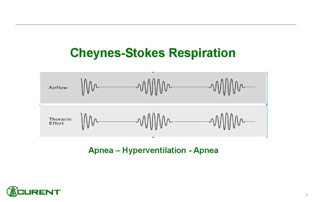 Cheynes-Stokes Respiration Apnea – Hyperventilation - Apnea 7 