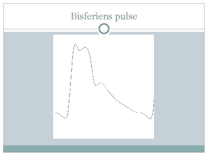 Bisferiens pulse 