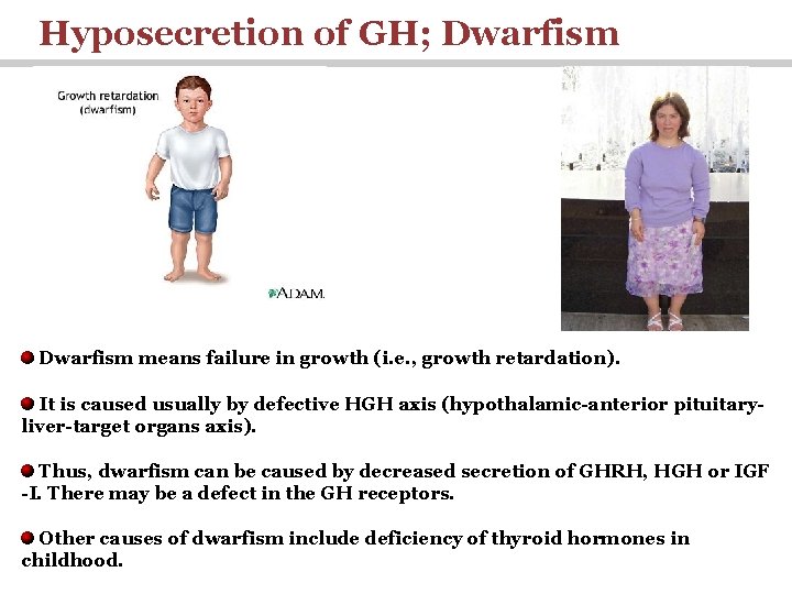 Hyposecretion of GH; Dwarfism means failure in growth (i. e. , growth retardation). It