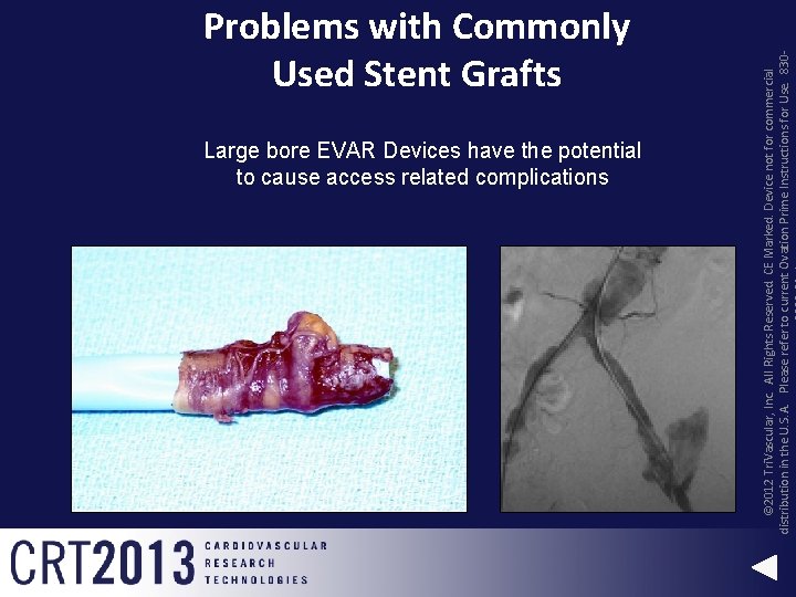 Large bore EVAR Devices have the potential to cause access related complications © 2012