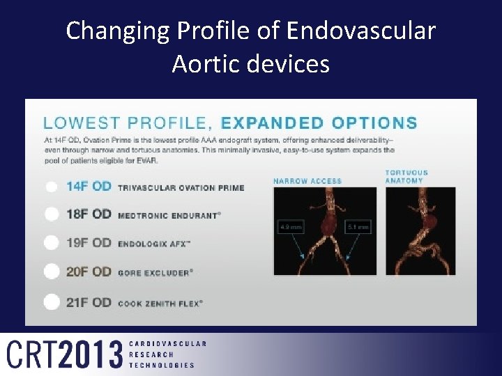 Changing Profile of Endovascular Aortic devices 