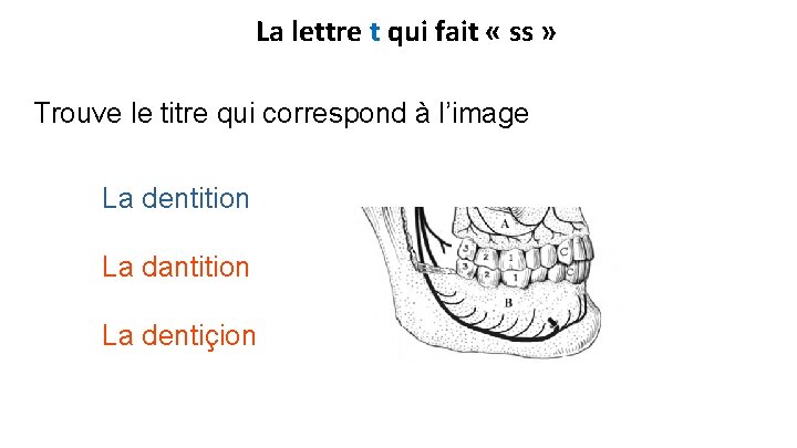 La lettre t qui fait « ss » Trouve le titre qui correspond à