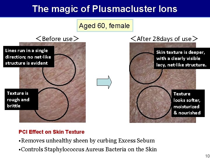 The magic of Plusmacluster Ions Aged 60, female ＜Before use＞ Lines run in a