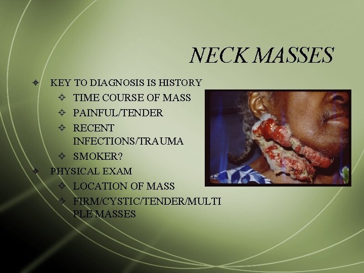 NECK MASSES KEY TO DIAGNOSIS IS HISTORY TIME COURSE OF MASS PAINFUL/TENDER RECENT INFECTIONS/TRAUMA