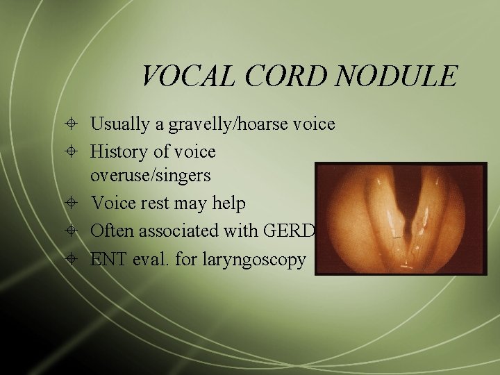 VOCAL CORD NODULE Usually a gravelly/hoarse voice History of voice overuse/singers Voice rest may