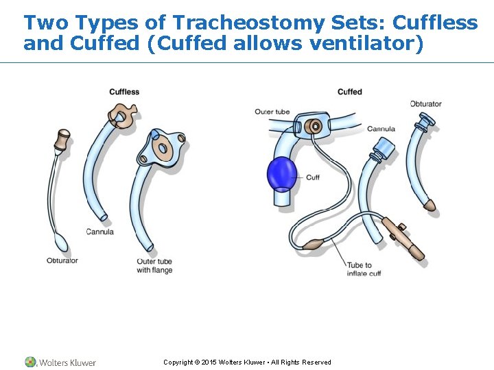 Two Types of Tracheostomy Sets: Cuffless and Cuffed (Cuffed allows ventilator) Copyright © 2015