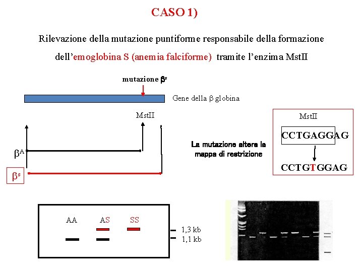 CASO 1) Rilevazione della mutazione puntiforme responsabile della formazione dell’emoglobina S (anemia falciforme) tramite