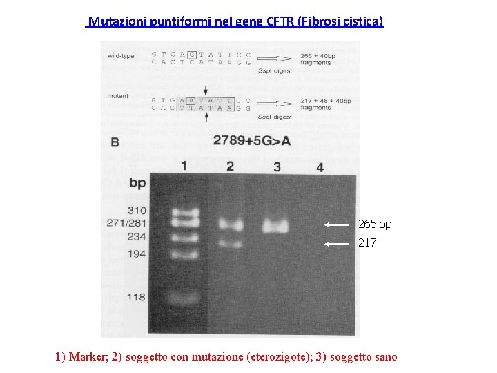 Mutazioni puntiformi nel gene CFTR (Fibrosi cistica) 265 bp 217 1) Marker; 2) soggetto