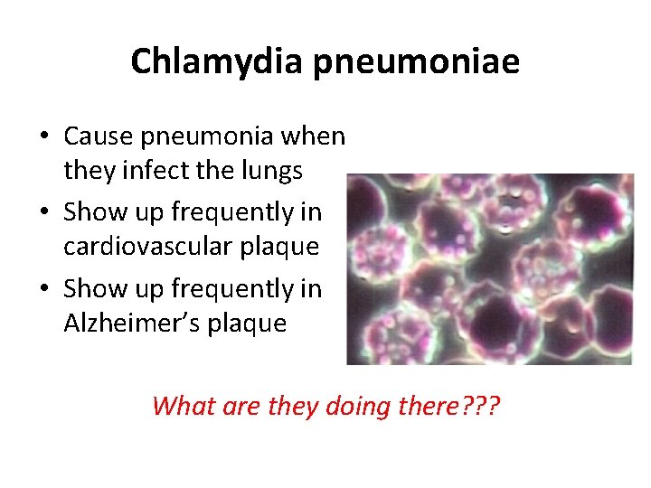 Chlamydia pneumoniae • Cause pneumonia when they infect the lungs • Show up frequently