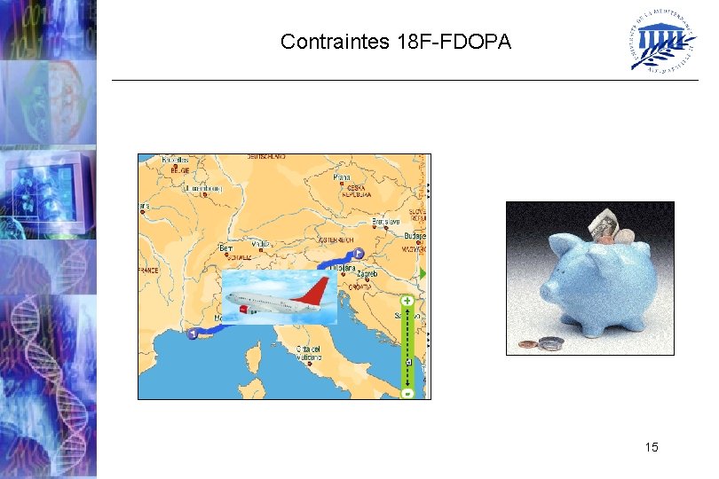 Contraintes 18 F-FDOPA 15 