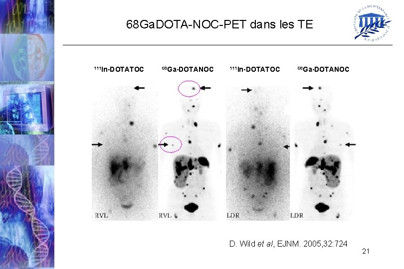 68 Ga. DOTA-NOC-PET dans les TE 111 In-DOTATOC 68 Ga-DOTANOC D. Wild et al,