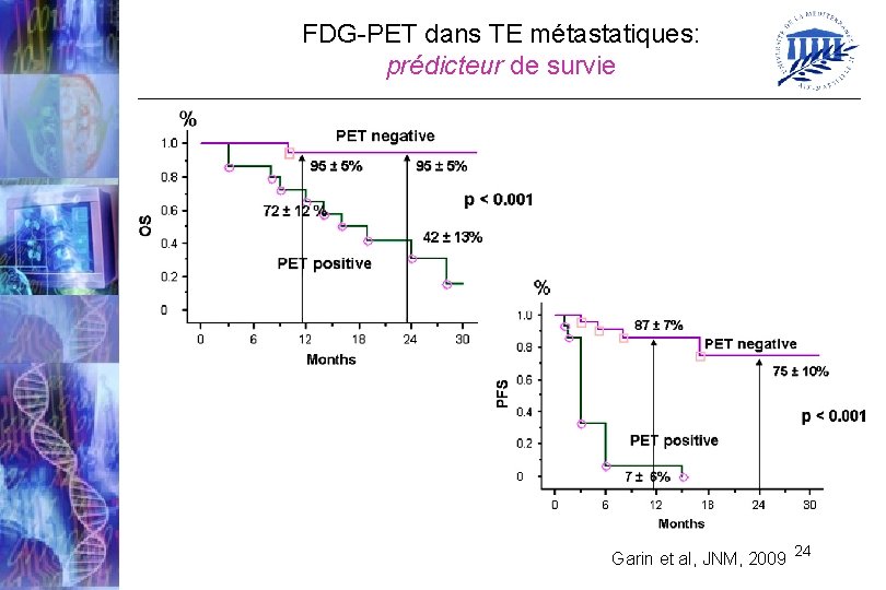 FDG-PET dans TE métastatiques: prédicteur de survie Garin et al, JNM, 2009 24 