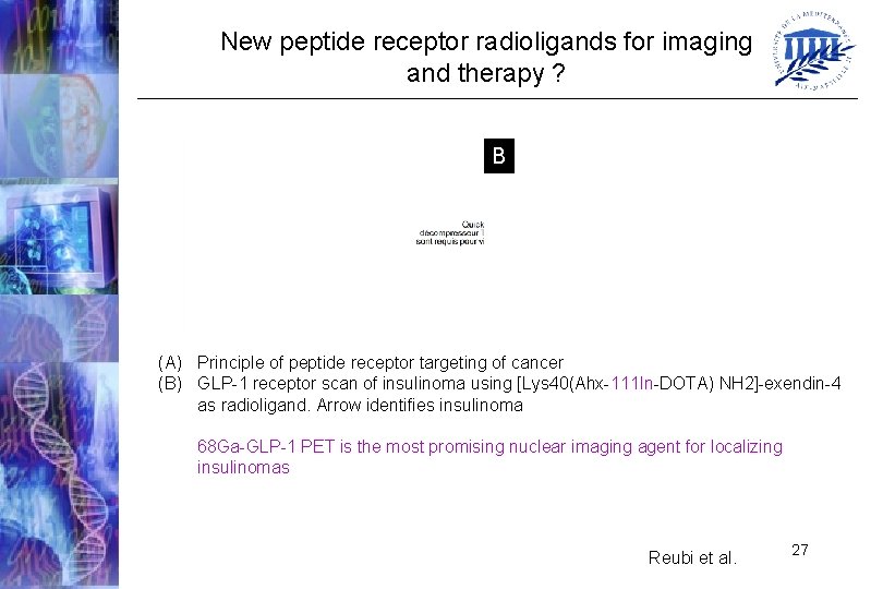 New peptide receptor radioligands for imaging and therapy ? B (A) Principle of peptide