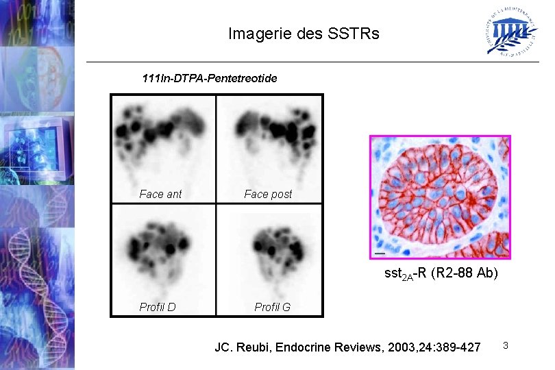 Imagerie des SSTRs 111 In-DTPA-Pentetreotide Face ant Face post sst 2 A-R (R 2