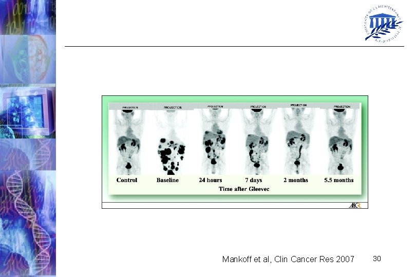 Mankoff et al, Clin Cancer Res 2007 30 