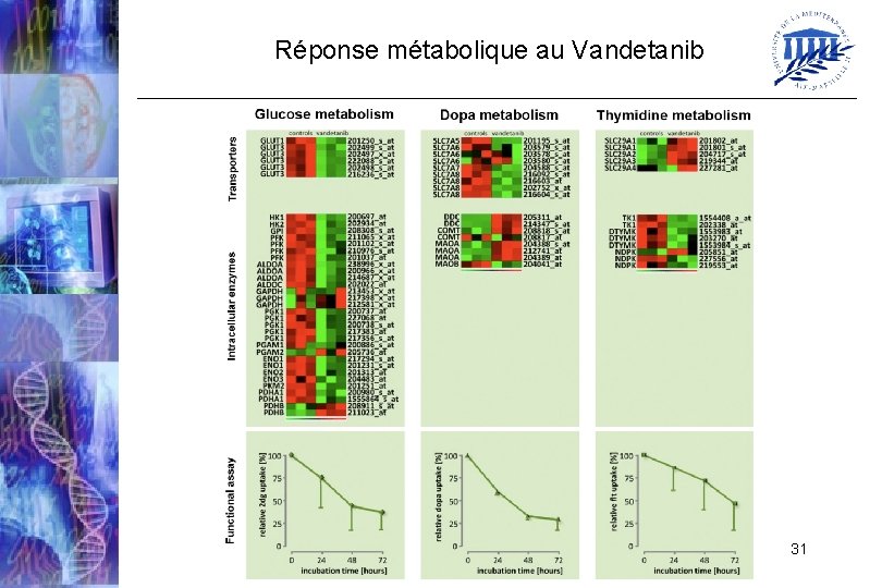 Réponse métabolique au Vandetanib 31 