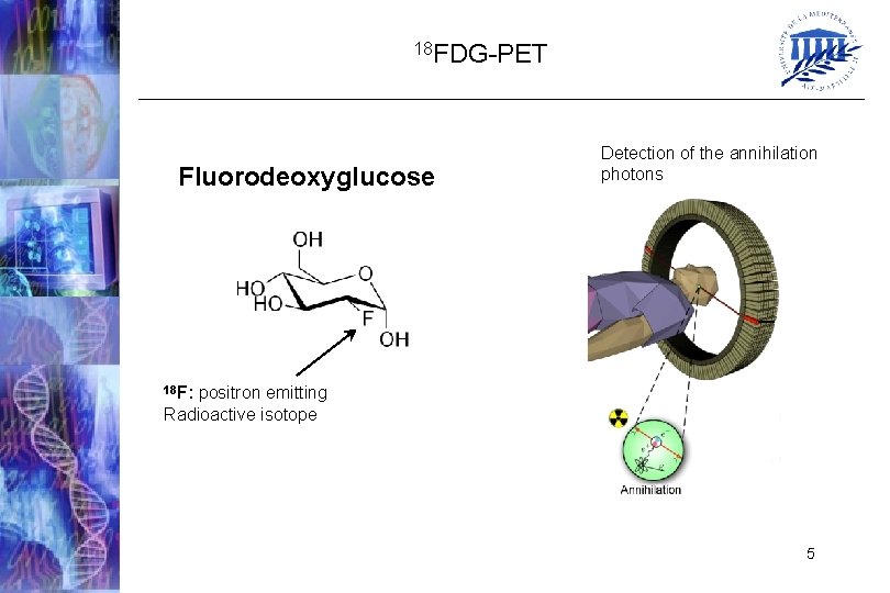 18 FDG-PET Fluorodeoxyglucose Detection of the annihilation photons 18 F: positron emitting Radioactive isotope