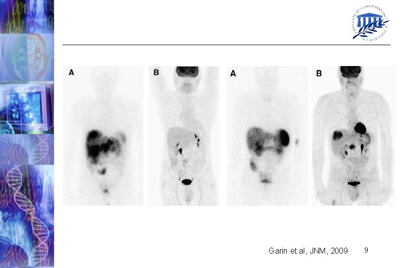 Garin et al, JNM, 2009 9 