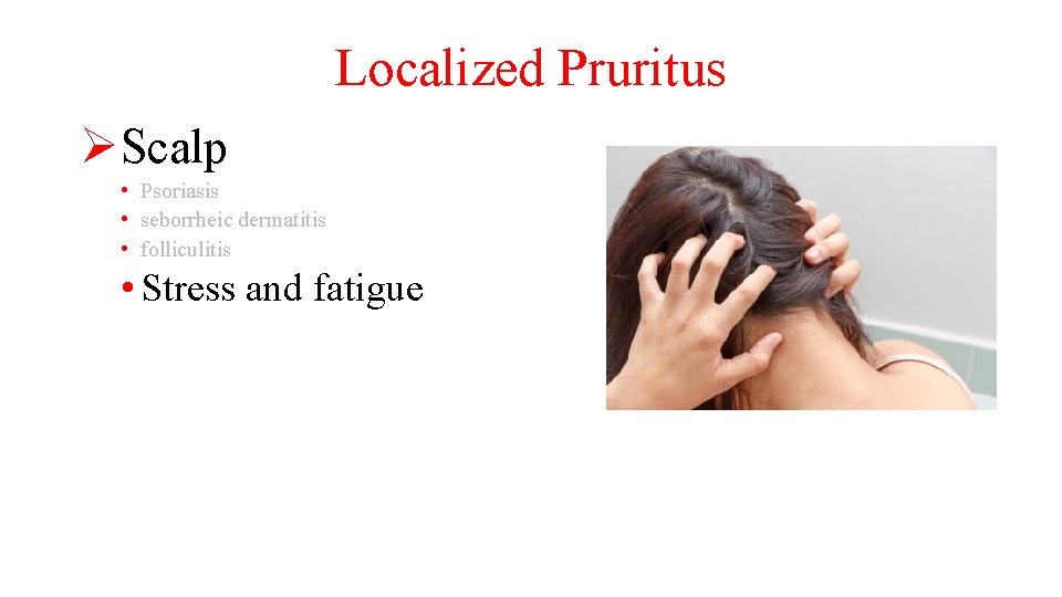 Localized Pruritus ØScalp • Psoriasis • seborrheic dermatitis • folliculitis • Stress and fatigue