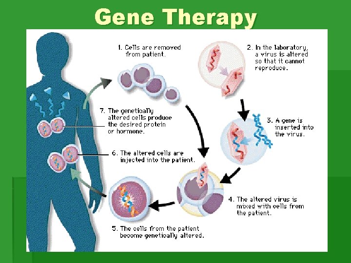 Gene Therapy Gene Therapy