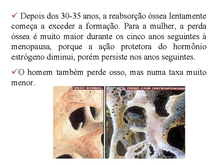 ü Depois dos 30 -35 anos, a reabsorção óssea lentamente começa a exceder a ü Depois dos 30 -35 anos, a reabsorção óssea lentamente começa a exceder a