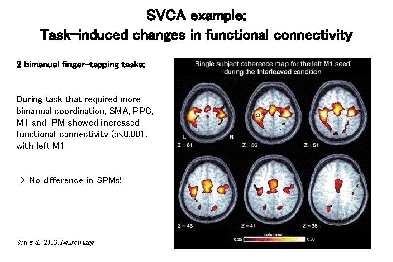 SVCA example: Task-induced changes in functional connectivity 2 bimanual finger-tapping tasks: During task that