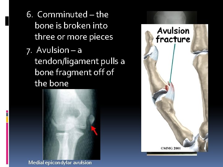 HAP Chapter 7 1 7 5 Notes SKELETAL