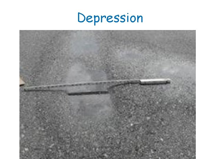 Depression 